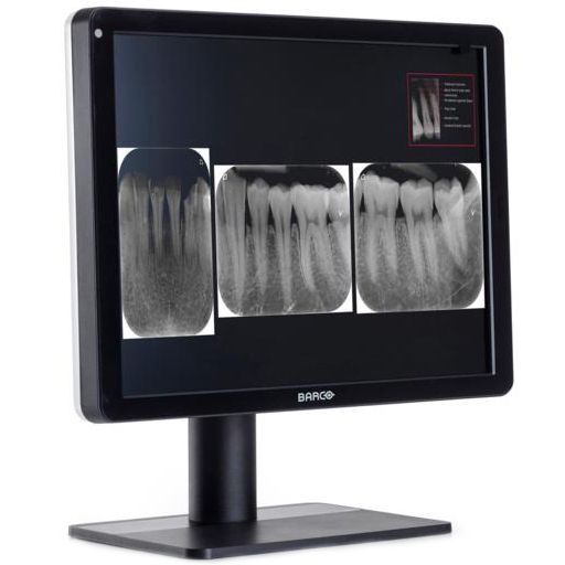 Медицинский монитор Barco Nio Color Dental