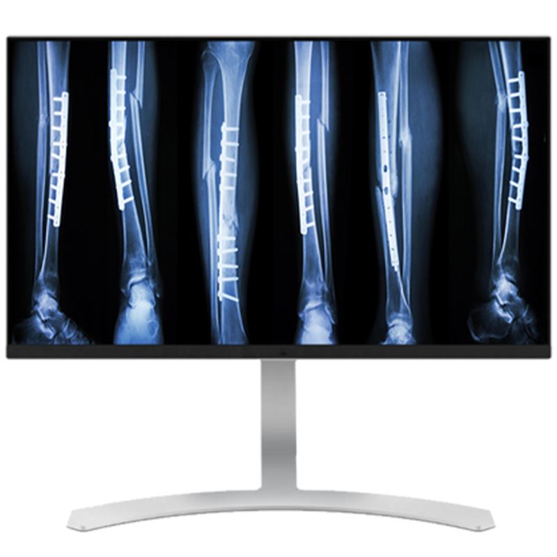 Медицинский монитор Double Black Imaging 27 8MP Color Clinical LED»