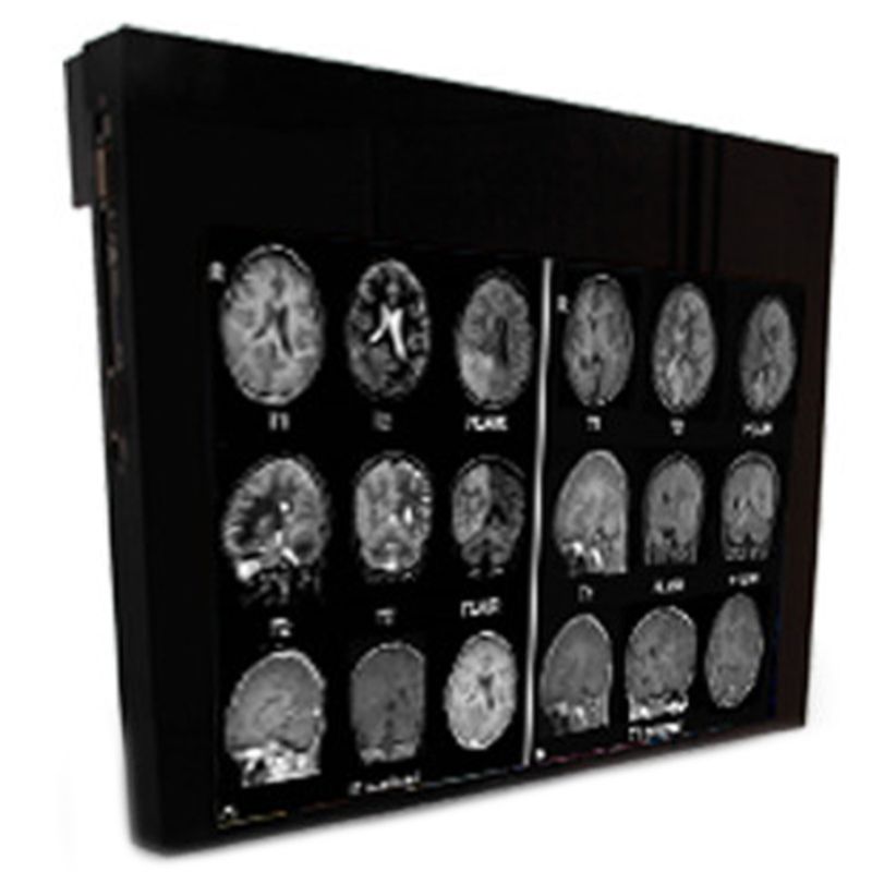 Медицинский монитор Double Black Imaging 32 MRSafe Display»